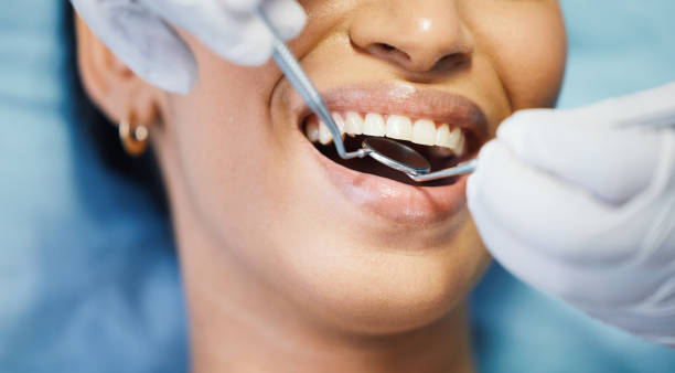 Best Broken or Cracked Tooth Emergency Dentist in Louisville, GA